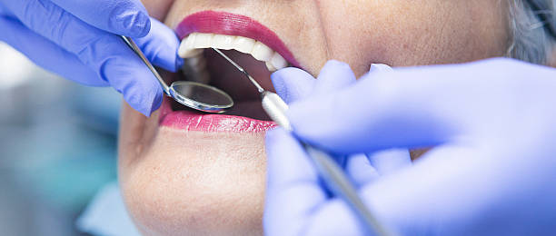 Best Emergency Treatment for Dental Infections or Abscesses in Durand, WI